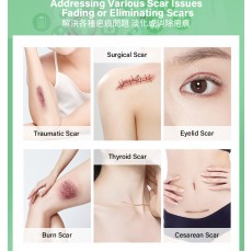 矽膠去疤修復貼 祛疤膏貼 袪疤貼(4cm x 1.5m)疤痕隱藏貼 自由裁剪祛疤貼 祛疤膏貼 剖腹產疤痕貼